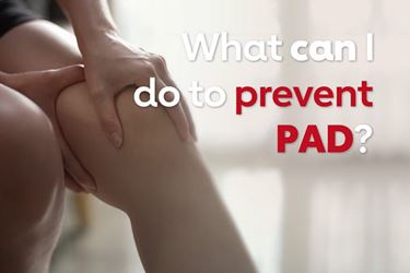 What can I do to prevent PAD? video screenshot