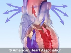 Illustration of a heart and high blood pressure Illustration of a heart and high blood pressure